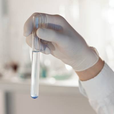 Columna Cromatográfica para Análisis de Alcohol