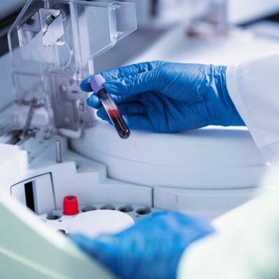 Columna Cromatográfica para Farmacéutica